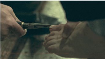 Tim removing Martys toenail on Ozark