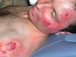 Laying in hospital after being run over with makeup applied scrapes.