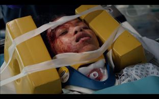 Simona Zivkovska in Casualty (1986)