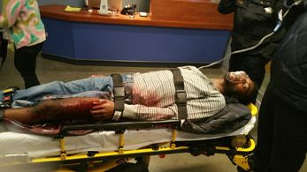 Barton Fitzpatrick as GSW Patient Episode 5 Season 1 Chicago Med