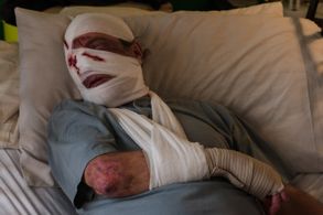 From The Consequences