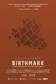 Birthmark