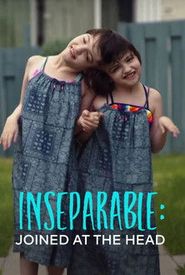 Inseparable: Joined at the Head