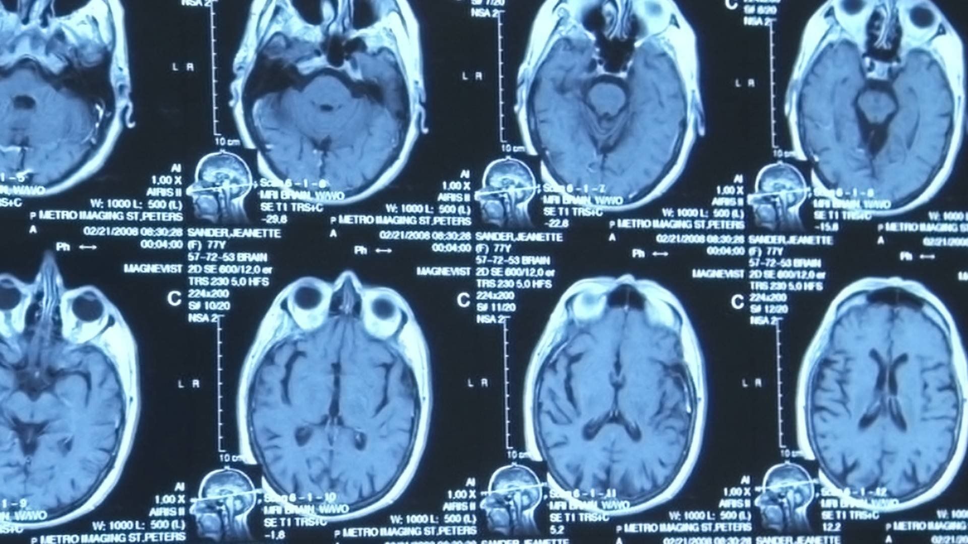 The Alzheimer's Project background