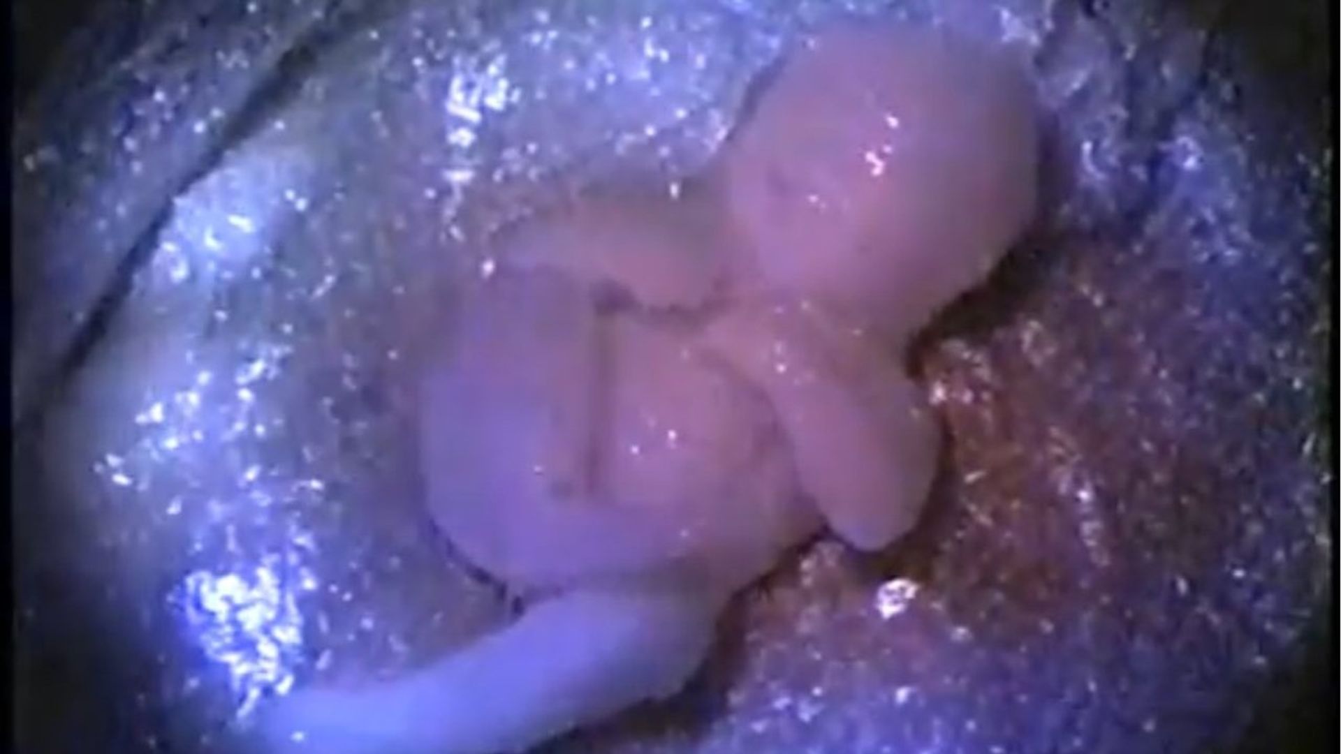 Busted Babies background