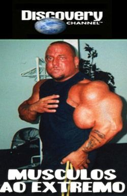 The Man Whose Arms Exploded