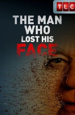 The Man Who Lost His Face