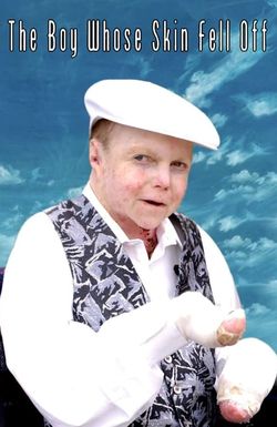 The Boy Whose Skin Fell Off