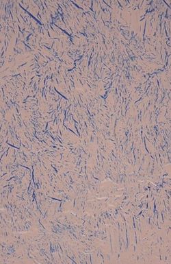 The Extravagant Shadows