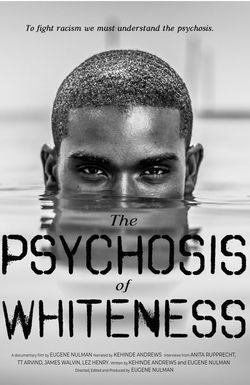 The Psychosis of Whiteness