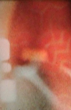 Along with the Phoenix