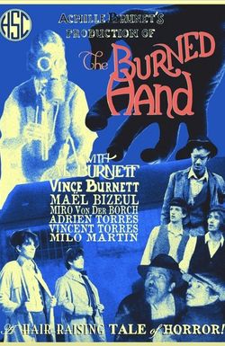 The Burned Hand