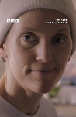My Brain: After the Rupture