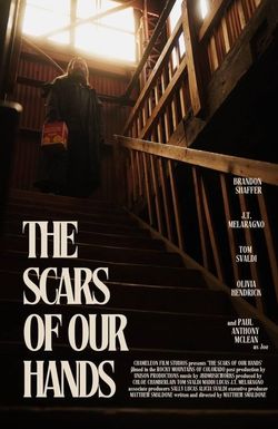 The Scars of Our Hands