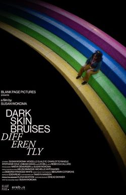 Dark Skin Bruises Differently