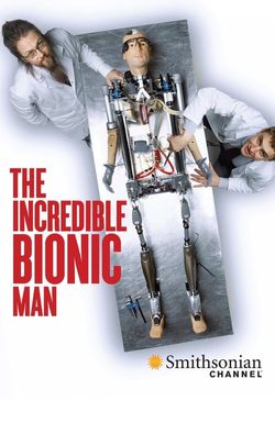 How to Build a Bionic Man