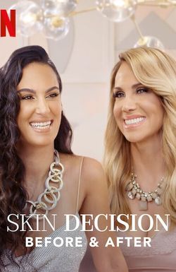 Skin Decision: Before and After