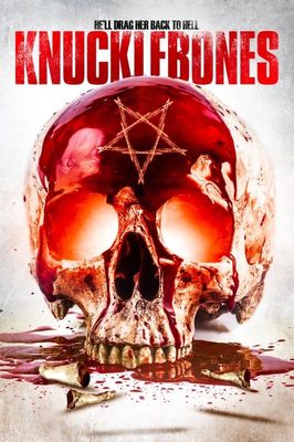 Knucklebones