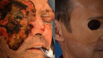 Episode 5 Mystery of the Eyelid