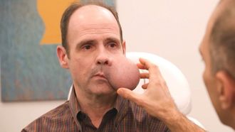 Episode 1 Tumorous Maximous