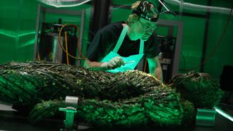 Episode 9 The Anatomy Lesson