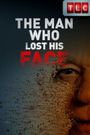 The Man Who Lost His Face