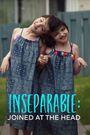 Inseparable: Joined at the Head